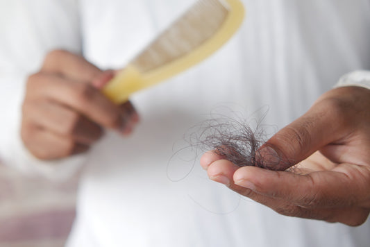 What is Alopecia Areata?